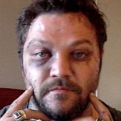 Why We Never Hear From Bam Margera Anymore