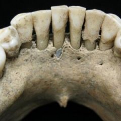 How a Blue Tooth Led Scholars to a Medieval Manuscript Mystery How a Blue Tooth Led Scholars to a Medieval Manuscript Mystery