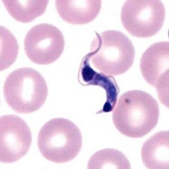 Scary Parasites That Can Control Human Brains Scary Parasites That Can Control Human Brains
