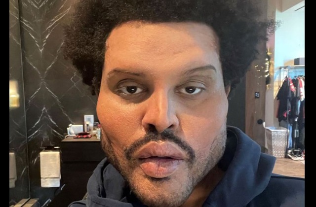 The Evolution Of The Weeknd's Face Transformation Explained